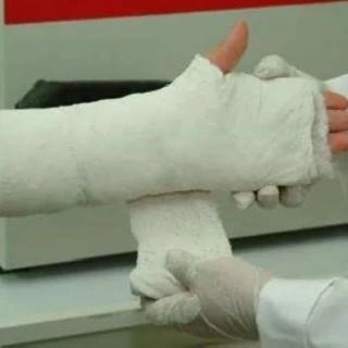 طرح توجیهی تولید گچ پزشکی