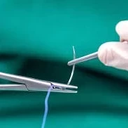 طرح توجیهی مطالعه امکان سنجی مقدماتی طرح اولیه  نخ بخیه